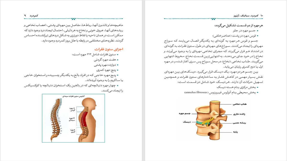 کمردرد سیاتیک آرتروز
